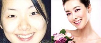 12 корейских актрис до и после пластики