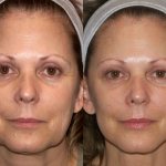 Non-surgical facelift with Margarita Levchenko. Video training lessons, the benefits of the method 