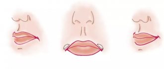 this area and significantly raise the corner of the mouth