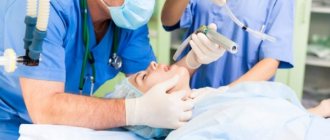 Endotracheal anesthesia. What is it, photos, videos, reviews 