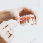 этапы установки имплантов зубов