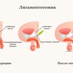 stages of penis enlargement