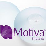Motive breast implants