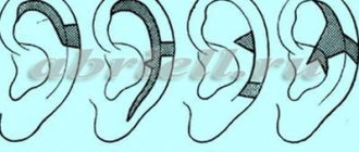 Ear correction