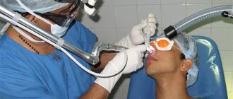 laser surgery to correct nasal septum