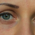 Meso ice (Mesoeye, Mesoeye C71) for the eyes. Photos before and after, reviews, price 