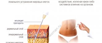 Features of the procedure