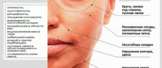 признаки старения кожи лица у женщин