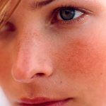 Rating of the TOP 10 best creams for rosacea in 2021
