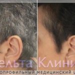 The result of gray hair treatment