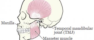 Рисунок 1. Кости и мышцы челюстей