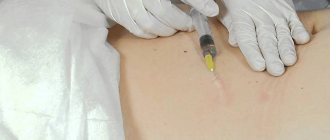 Vascular mesotherapy