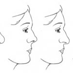 Типы носов
