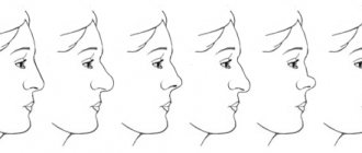 Типы носов