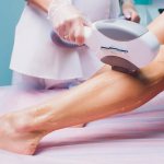 Harm from laser hair removal to humans